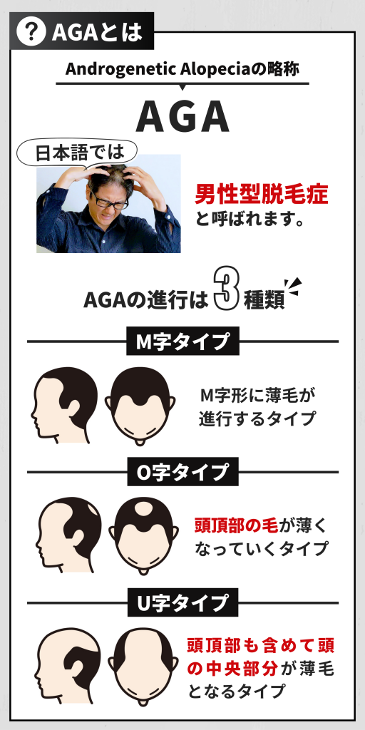 AGAの基礎知識