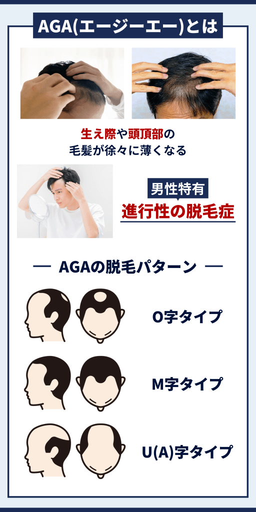 AGAのお役立ち情報