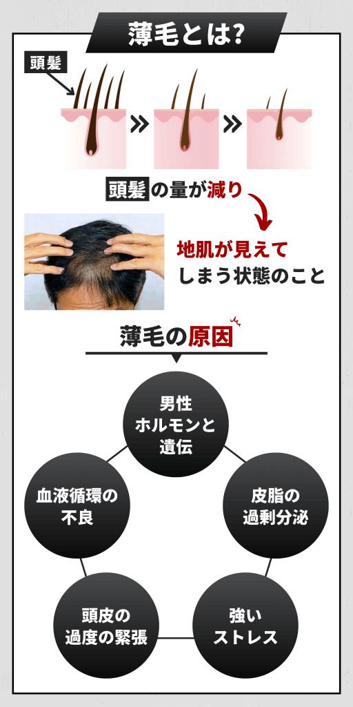 薄毛のお役立ち情報