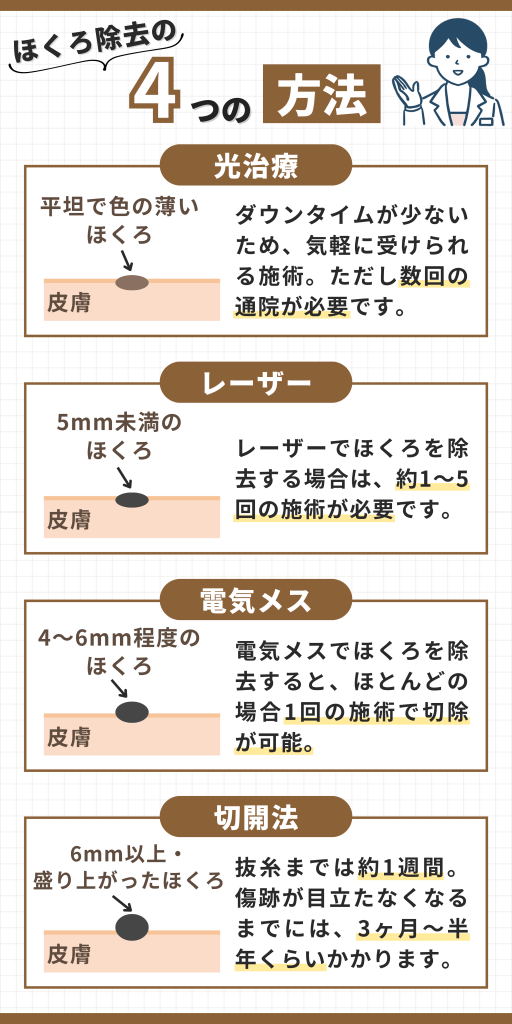 ほくろ除去の4つの方法