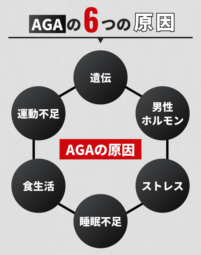 AGAの原因