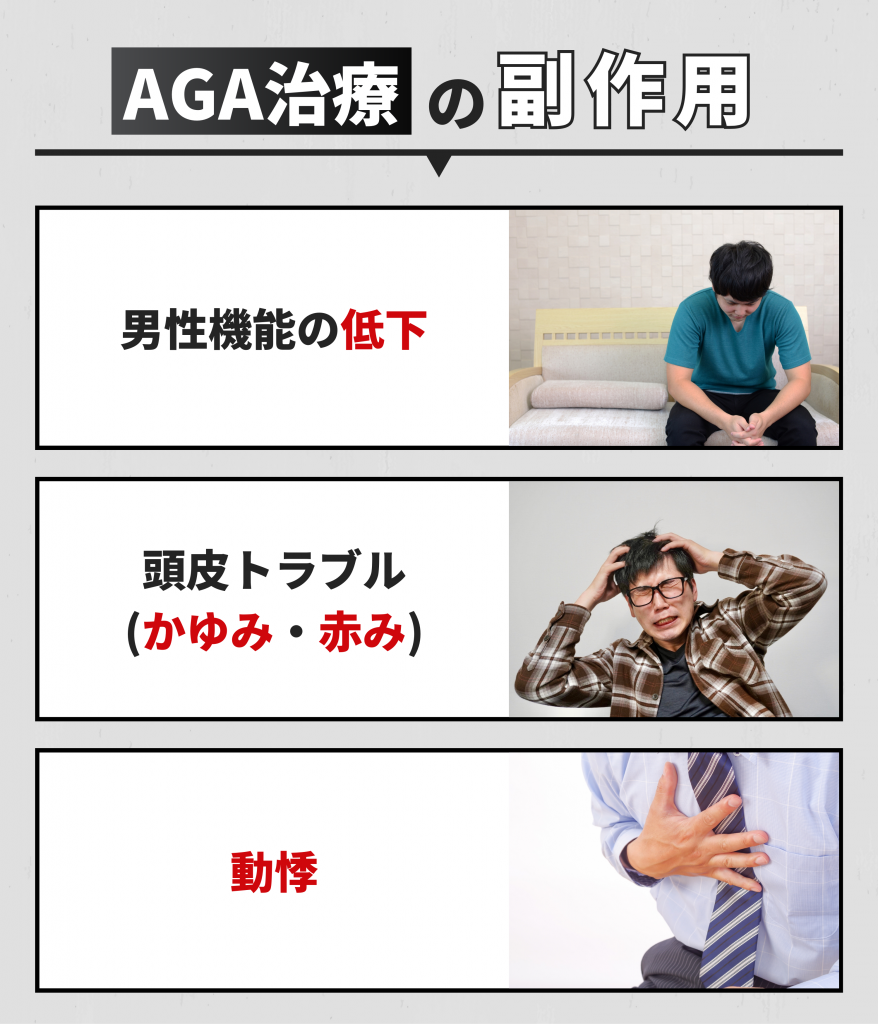 AGA治療の副作用