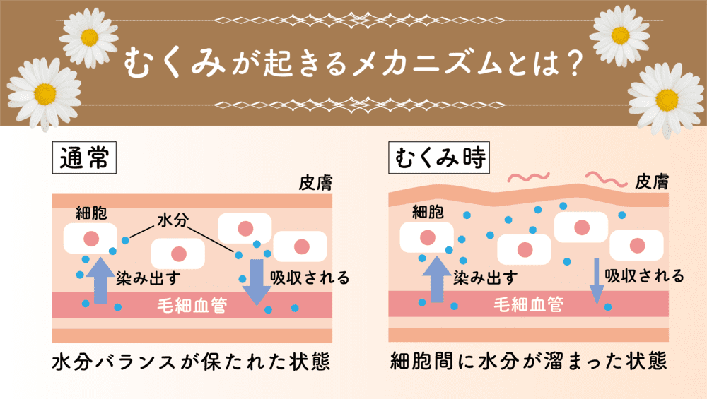 むくみのメカニズム