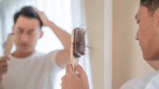 DクリニックのAGA治療の口コミ評判を徹底調査【効果が気になる人必見】 