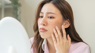 湘南美容クリニックのシミ取りレーザーの口コミ評判を徹底調査【効果が気になる人必見】 